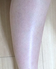 みいみいさん　膝下